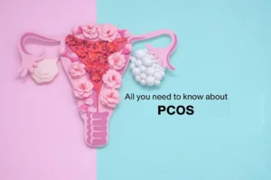 Dr. Megha Khanna, best gynecologist in Kolkata, advising a patient on managing PCOS through lifestyle changes and medication.